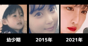 休井美郷の鼻の変化画像
