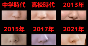 松岡茉優の鼻の変化画像
